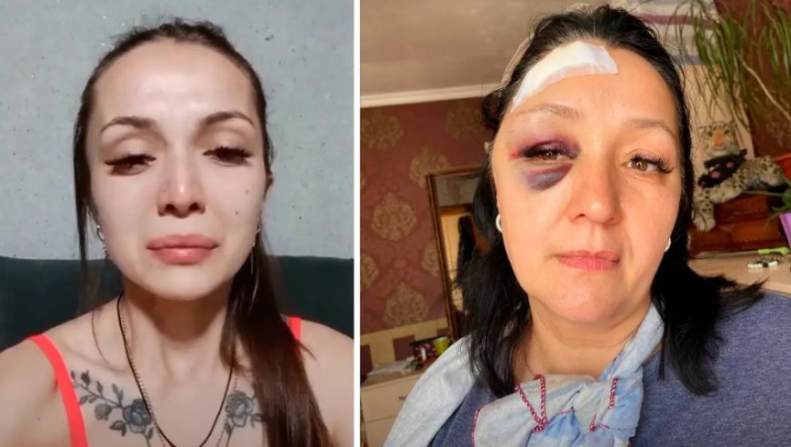 «Анамды темір сойылмен ұрды»: Алматы тұрғыны халықтан көмек сұрады (ВИДЕО)