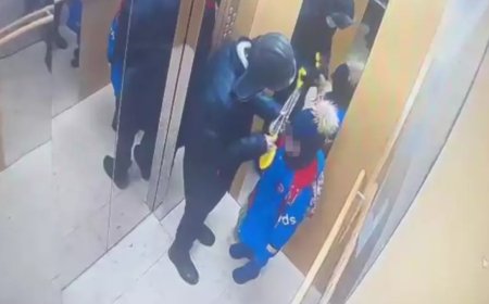 «Бір жақ беті мүлде қозғалмайды»: Лифтіде пышақталған баланың қазіргі жағдайы белгілі болды