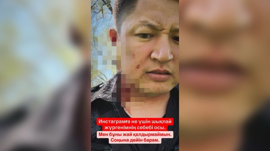«Мұны жай қалдырмаймын»: Нұрболхан Шараповтың қан-жоса болған суреті тарады