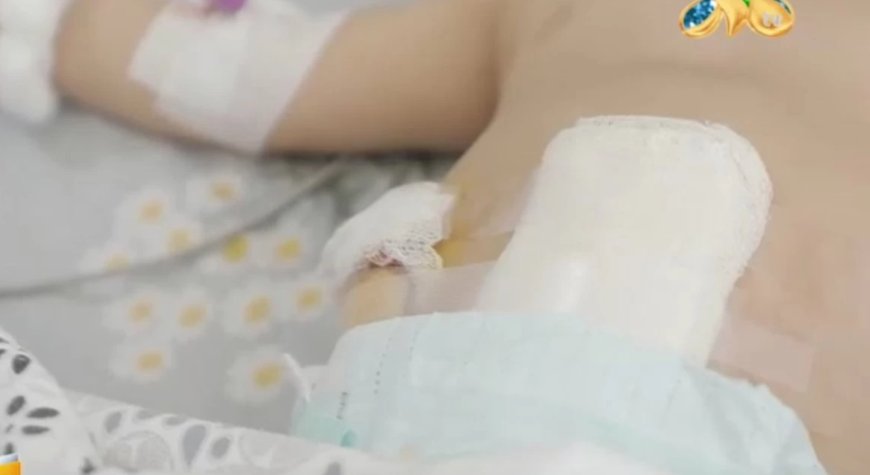«Лаваш пен фри жеген»: 10 айлық баланың ішектері іріңдеп кеткен