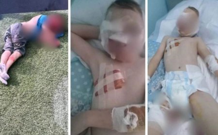 Иттерге таланған 10 жастағы баланың қазіргі жағдайы белгілі болды