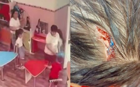 Таразда балабақша тәрбиешісі бүлдіршіннің басын жарып тастаған (ВИДЕО)