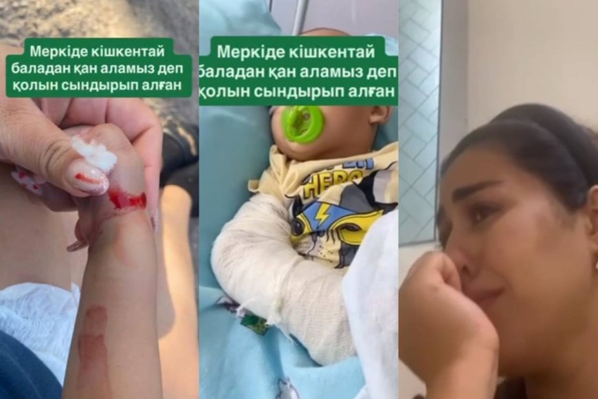 «Меркі ауруханасына барсаң, тірі шықпайсың: қан алмақ болған дәрігерлер баланың қолын сындырып жіберген